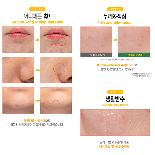 Paul Medison CareDerm Thin Spotpatch Honey